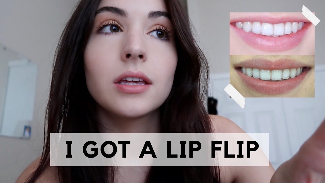What is a lip flip injection